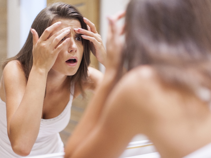 Akne oder unreine Haut? Mit diesen Tipps kann ein unreines Hautbild verbessert werden