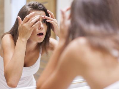 Akne oder unreine Haut? Mit diesen Tipps kann ein unreines Hautbild verbessert werden